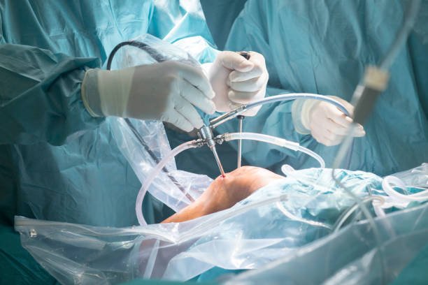 Arthroscopy Sports Injury